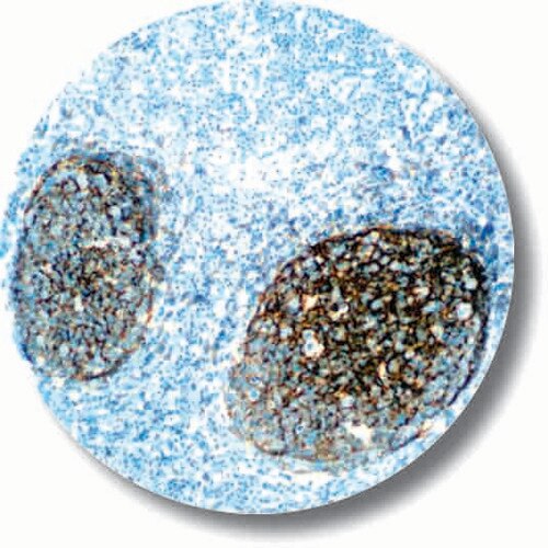 IHC of CD21 on an FFPE Tonsil Tissue